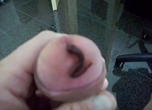 Worm crawls up this dude's urethra